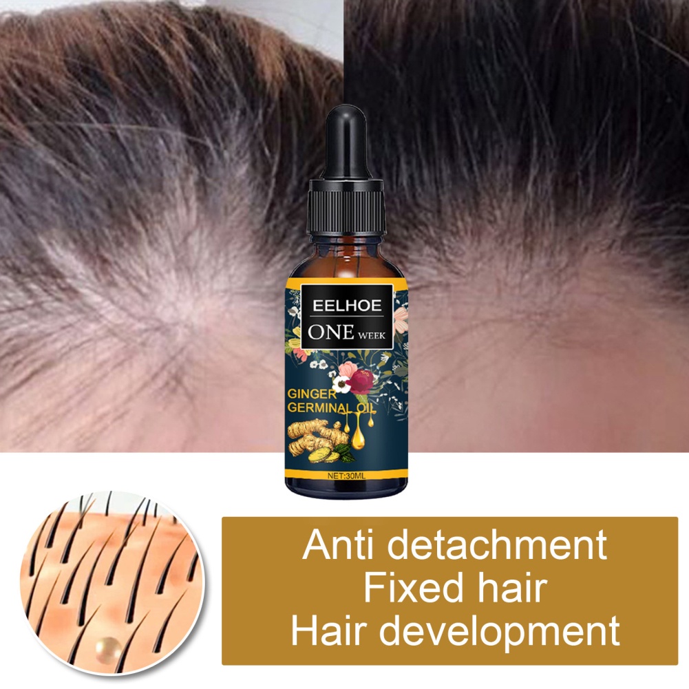 Eelhoe Tinh Dầu Gừng Mọc Tóc 30Ml Dung Dịch Dinh Dưỡng Chăm Sóc Chân Tóc Da Đầu-Ampere