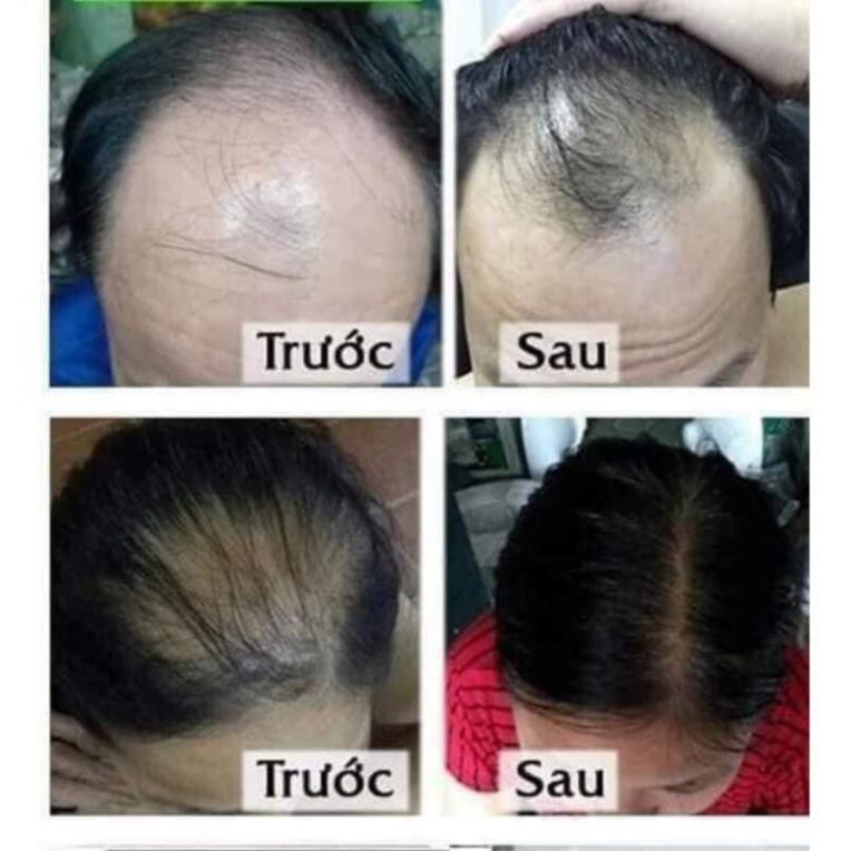 [Chính hãng] Dầu gội Thanh Mộc Hương | BigBuy360 - bigbuy360.vn