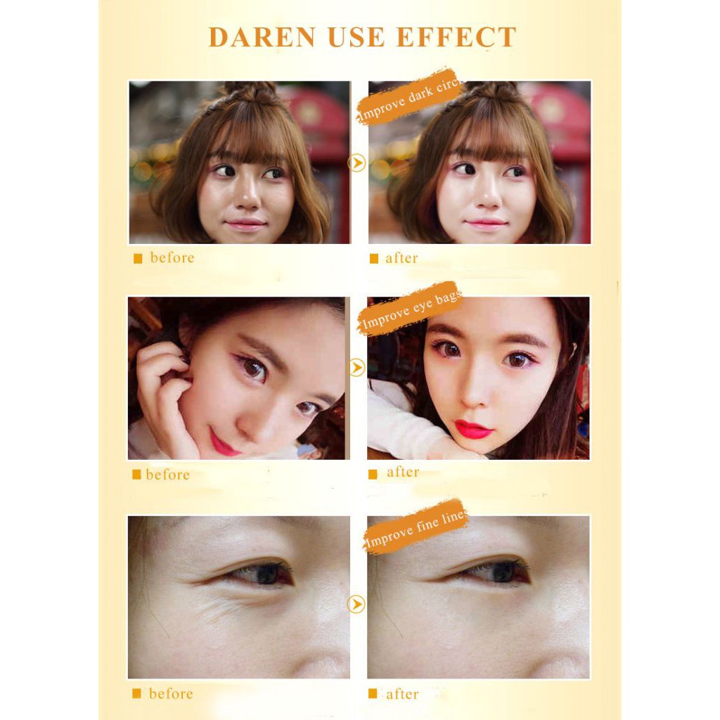 Mặt nạ mắt collagen xóa quầng thâm và nếp nhăn hiệu quả chất lượng cao