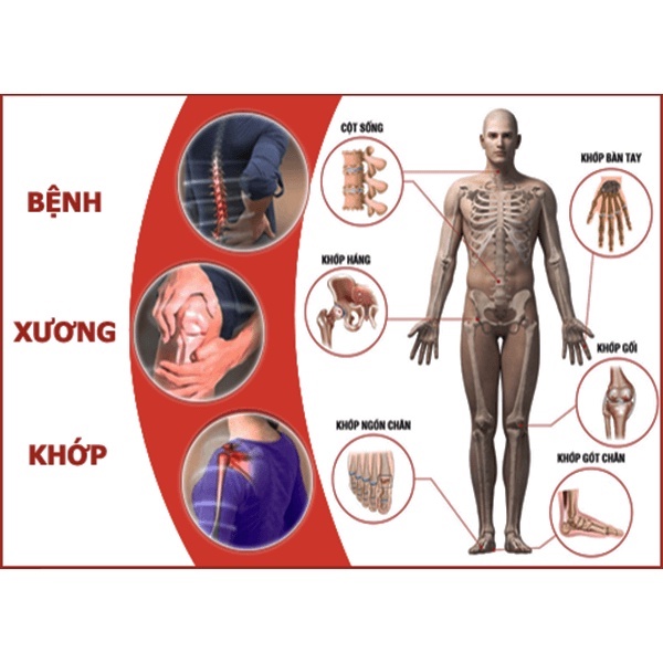 Dầu xoa bóp, Rượu Xoa Bóp Mã Tiền Xương Khớp Gia Truyền Bình Định