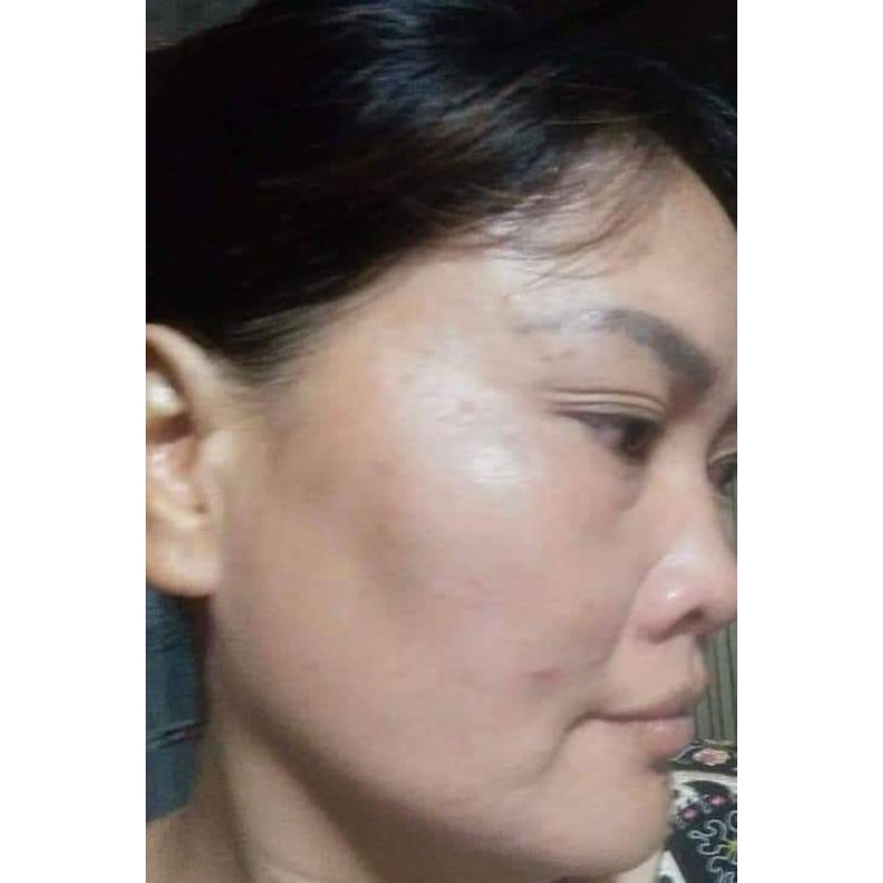 Bột Đánh Nám Tàn Nhang (gồm 2 bột và 1 lọ collagen đặc) | BigBuy360 - bigbuy360.vn