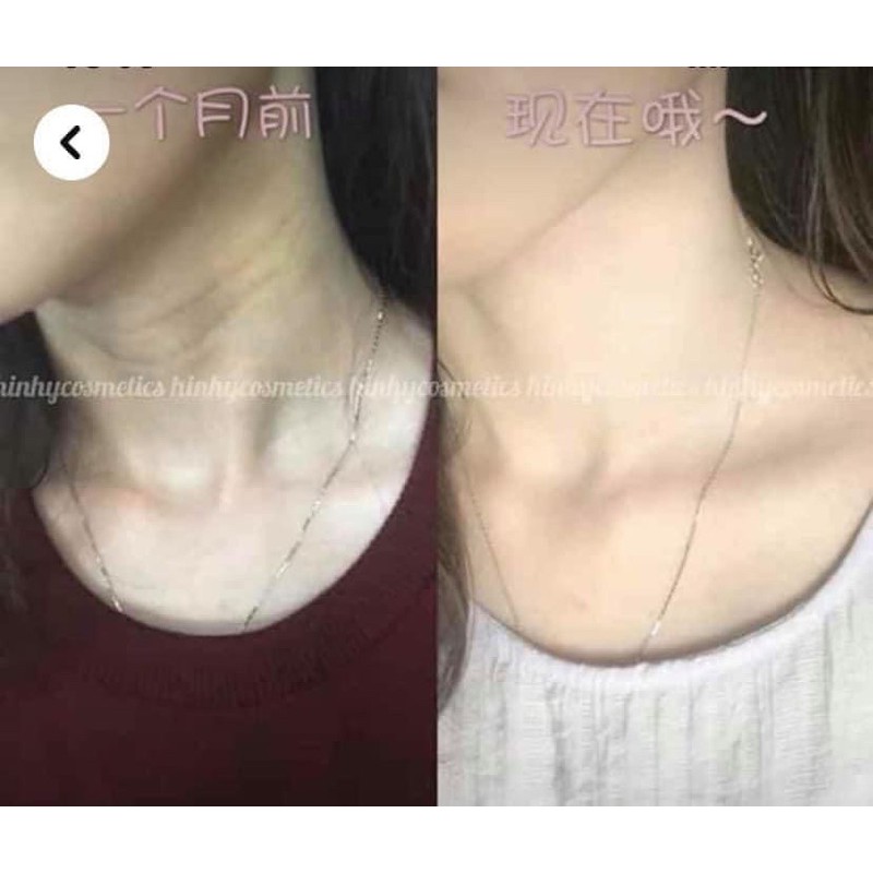 Kem dưỡng cổ Medipeel | BigBuy360 - bigbuy360.vn