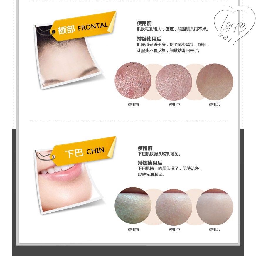 Mặt nạ lột mụn đầu đen làm sạch sâu lỗ chân lông | BigBuy360 - bigbuy360.vn