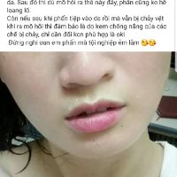 Phấn suchie