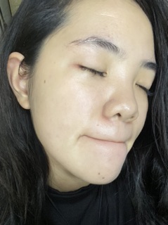 Serum tinh chất tế bào gốc