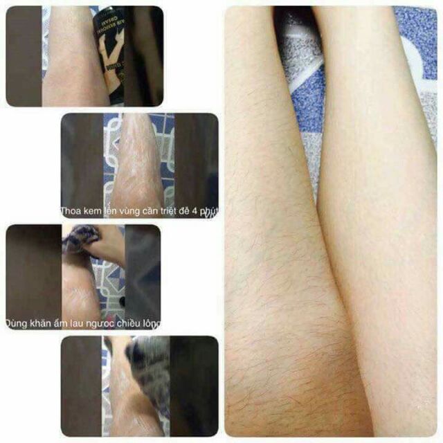 KEM TẨY LÔNG MAGIC SKIN | BigBuy360 - bigbuy360.vn