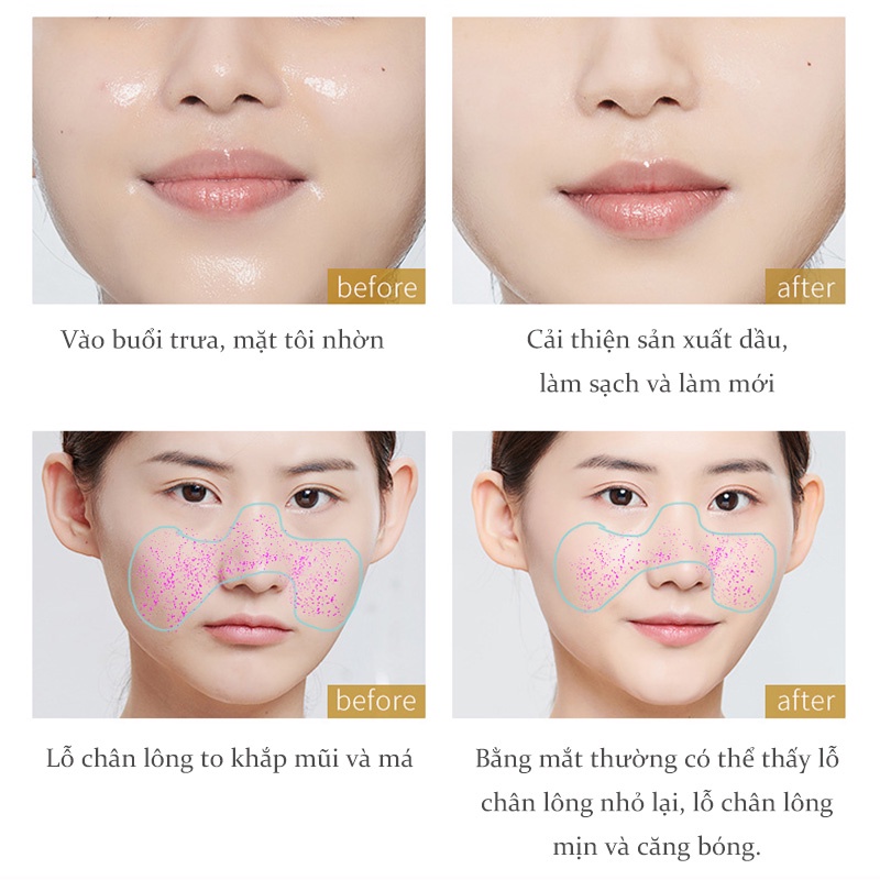 100G Mặt nạ làm dịu trẻ hóa dưỡng ẩm cho giấc ngủ CalendulaLàm dịu và dưỡng daThu nhỏ lỗ chân lông (MDL-MM-1)