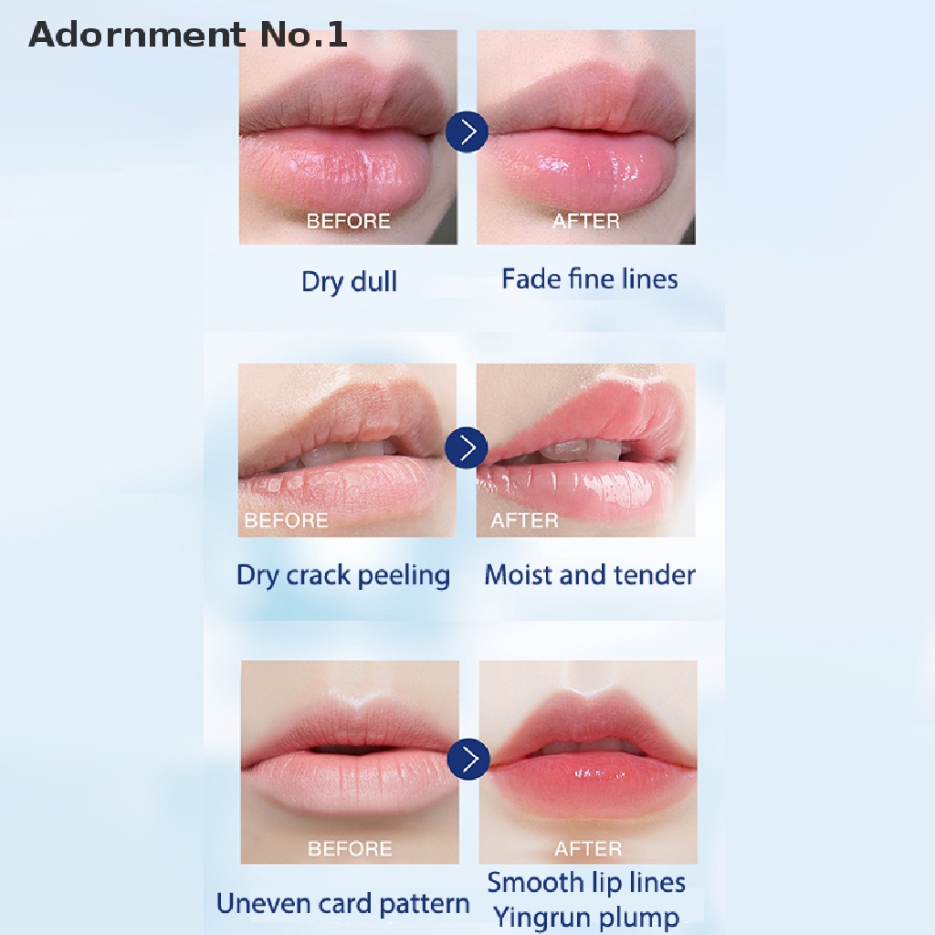 VASELINE  Lọ Hoa Giữ Ẩm Môi Chống Nứt Nẻ Lâu Trôi