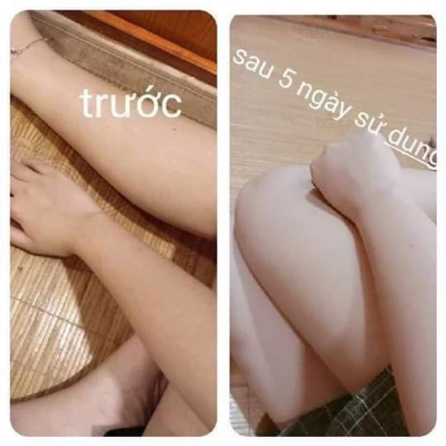 50 Viên Vitamin Cấy Trắng Sa Thị | Thế Giới Skin Care