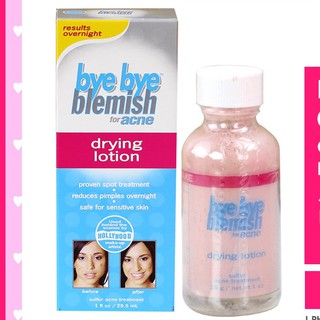 Kem hỗ trợ giảm mụn Bye Bye Blemish Drying Lotion hiệu quả giảm mụn cao được đánh giá tốt trên diễn đàn làm đẹp thế giới