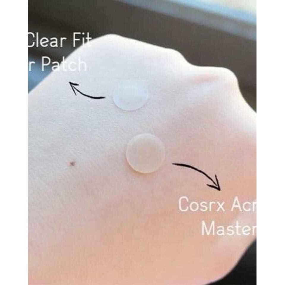 Miếng dán mụn Cosrx Acne Pimple Master Patch (Đỏ) / Cosrx Clear Fit Master Patch (Đen) / Cosrx AC Collection Acne