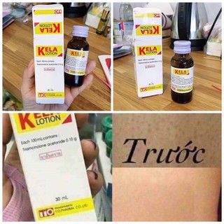 KELA LOTION XÓA VIÊM LỖ CHÂN LÔNG 60ML