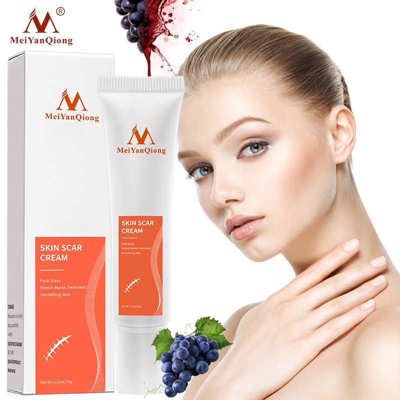 MeiYanQiong Acne Scar Removal Cream Skin Repair Stretch Marks giảm sẹo lồi, lõm, sẹo thâm, do mụn giúp phục hồi các tổn thương trên da thúc đẩy tái tạo da 15ml