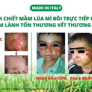 Gel Fitostimoline Proctogel (hàng chính hãng Ý)(làm lành vết thương hở...)