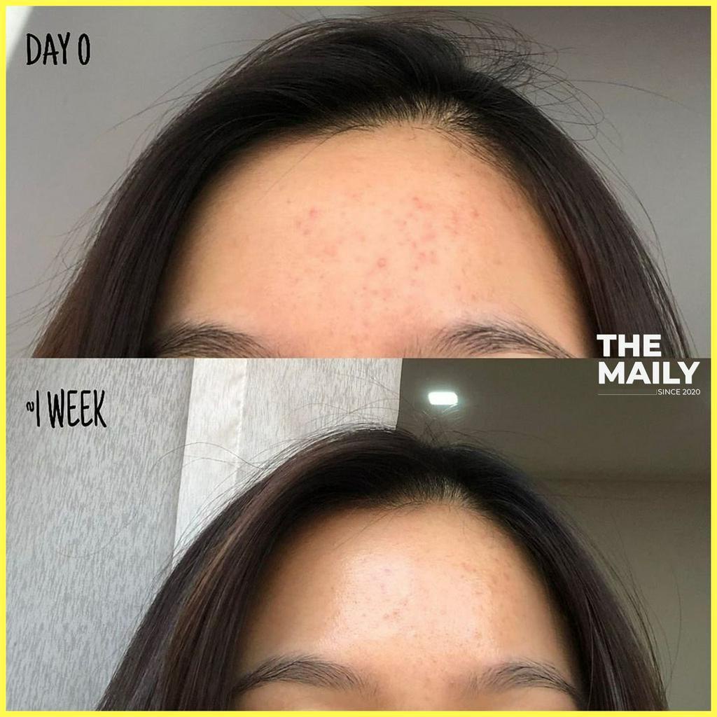 Tinh Chất Làm Sáng Da Chứa Niacinamide ROUND LAB 1025 Dokdo Tone-Up Ampoule 30mL