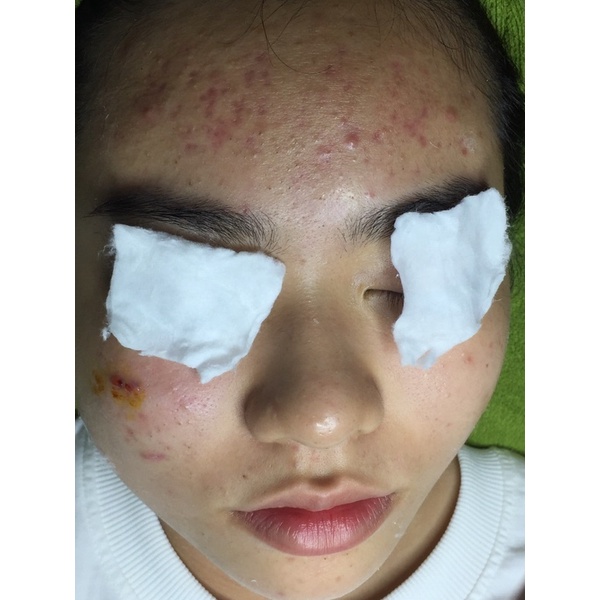 Bộ kem tái tạo da 210