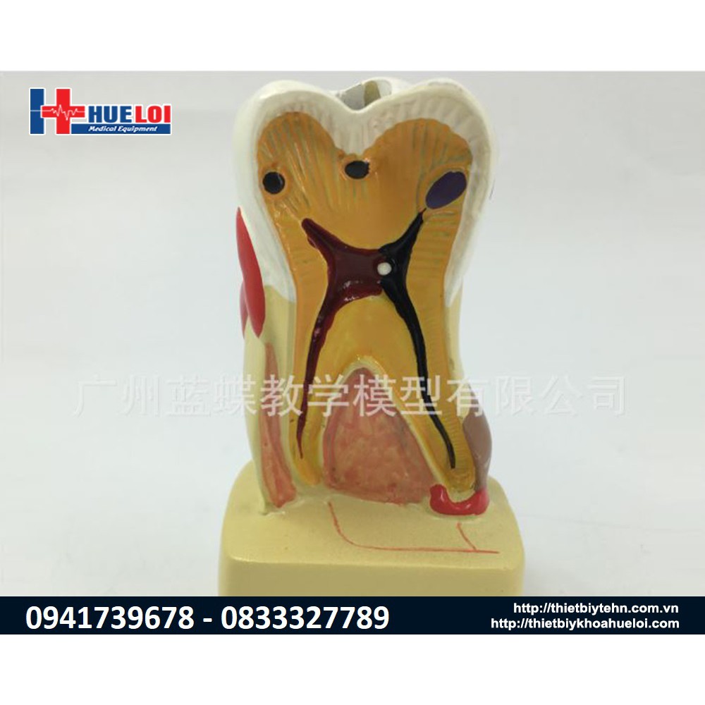 Mô hình bệnh lý về răng qua các giai đoạn