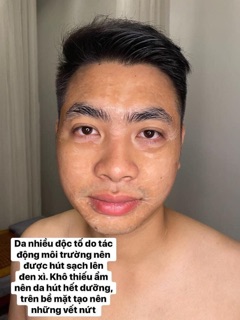 Set lẻ GEL NÂNG CƠ THẢI ĐỘC CARE CELLA