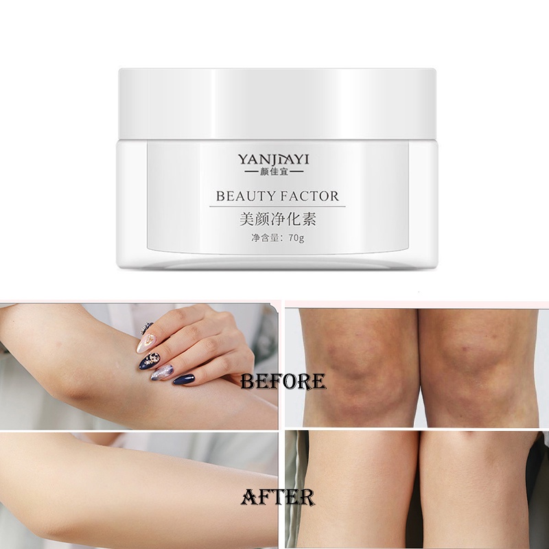 70g YANJIAYI Beauty Factor Joint Melanin Eemovermelatonin Whitening Brighten The Skin Tone Hydrating Moisturizing Cream