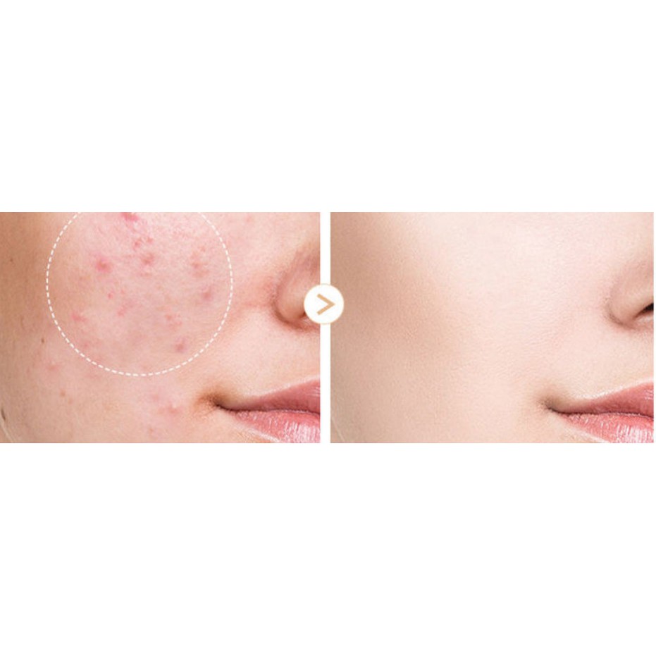 Kem che khuyết điểm SKYVII 5203 nội địa chính hãng che phủ tốt mịn da lâu trôi sỉ tốt NGỰA BEAUTY | BigBuy360 - bigbuy360.vn