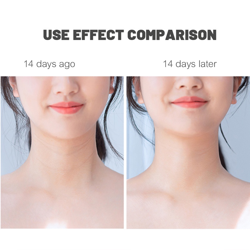 1 Mặt Nạ Sữa Dê Dưỡng Ẩm Làm Trắng Nâng Da Cổ Chống Nếp Nhăn