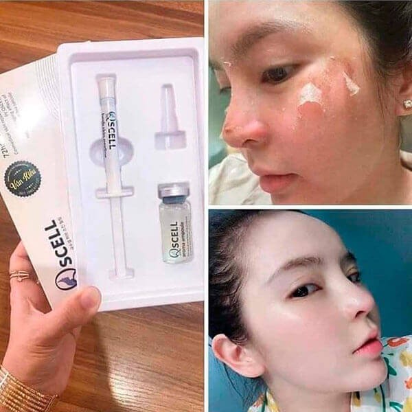 Vi Tảo Thay Da Sinh Học QSCELL số 1 Hàn Quốc