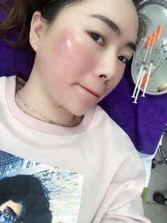 DNA cá hồi Placentex