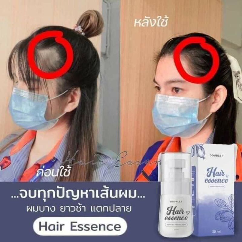 ✨Serum dưỡng tóc nhanh dài đẹp 👩🏻Hair Essence 💙chính hãng