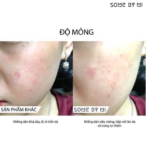 Miếng Dán Mụn Some By Mi Clear Spot Patch Yunaa Cosmetics | WebRaoVat - webraovat.net.vn