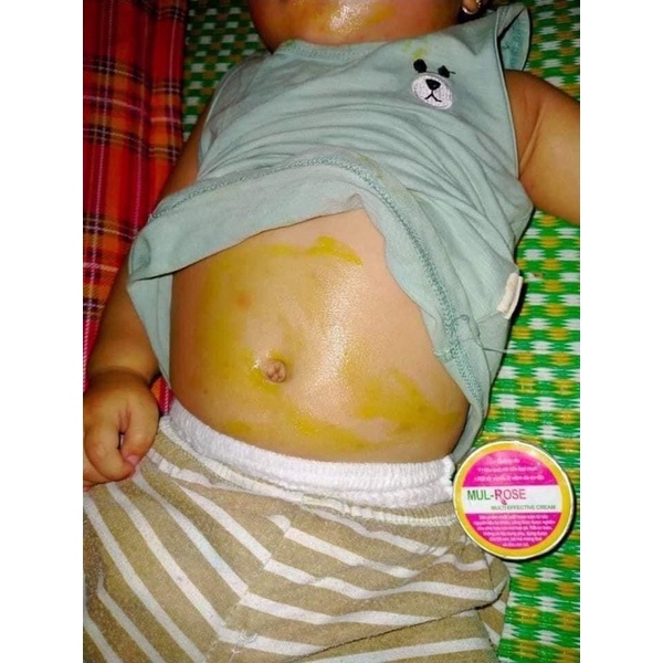 [Chính hãng] Kem nghệ đa năng Mulrose ngừa mụn đẹp da mờ sẹo