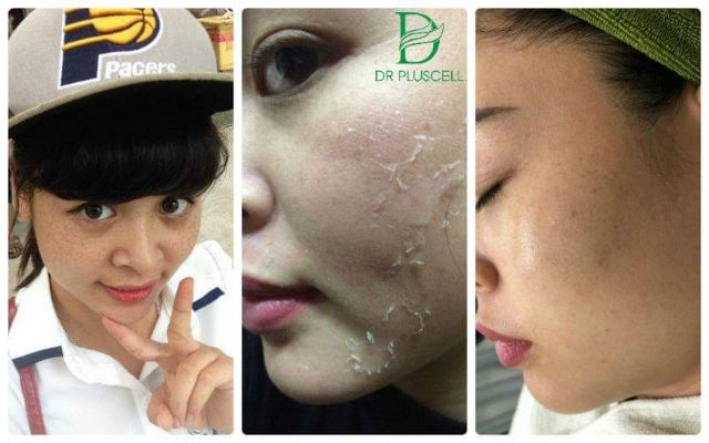 Siêu vi kim tảo biển Nano Tox Peel Dr Pluscell thế hệ đột phá mới 2019 | BigBuy360 - bigbuy360.vn