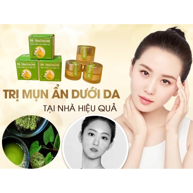 (CHÍNH HÃNG) KEM MỤN DIẾP CÁ