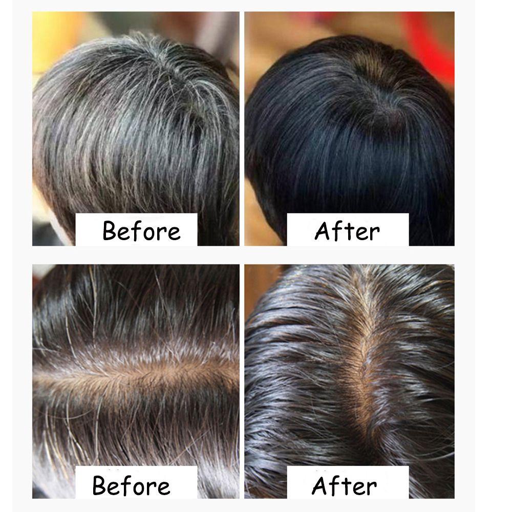 Dầu Gội Dưỡng Tóc Chống Gàu Phục Hồi Da Đầu Thành Phần Hữu Cơ Tự Nhiên
