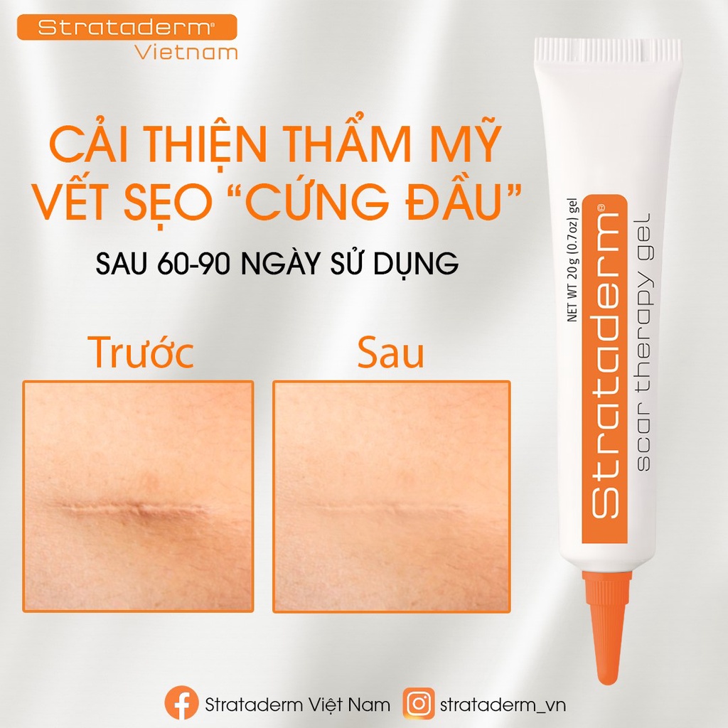 Gel Silicone ngăn ngừa sẹo lồi, sẹo xấu, sẹo lâu năm Strataderm 20g