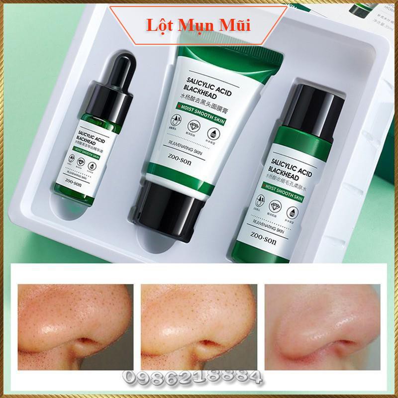 Bộ 3 sản phẩm lột mụn đầu đen Zoo Son Salicylic Acid Blackhead Care Set thu nhỏ lỗ chân lông BZB3