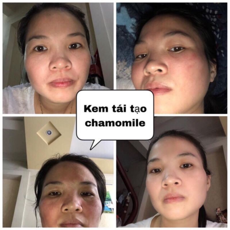 Kem chamomile hồng sâm