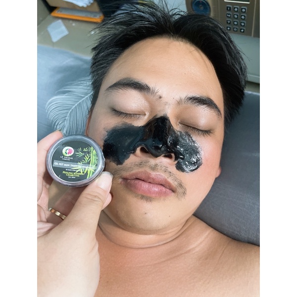 lột mụn than tre