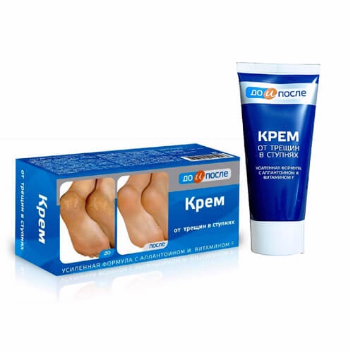 Kem Ngăn Ngừa Và Phục Hồi Nứt Nẻ Gót Chân Kpem Nga 50ml