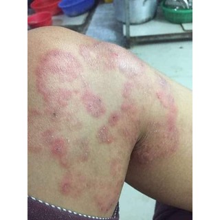 [shop yêu thích] Kem Bôi Da Lan Chi [siêu rẻ]