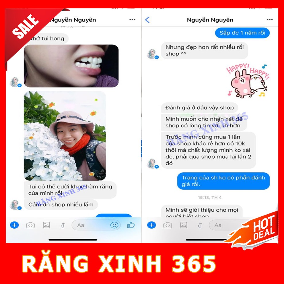 Niềng Răng Bí Mật ( Hàng Chính Hãng )