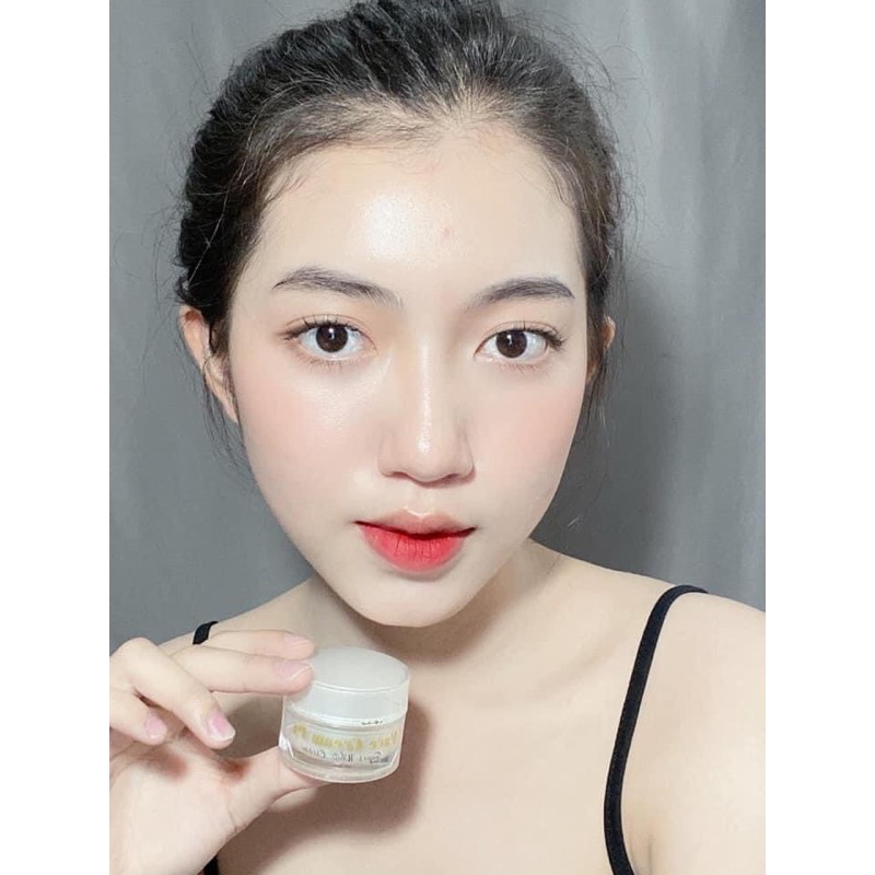 Kem mờ thâm dưỡng trắng sau 5 ngày ( Face cream P1 Ponry ) co kèm quà