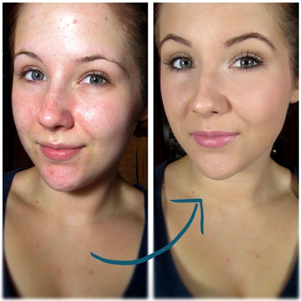 KEM NỀN  DA DẦU 110-150-220-240