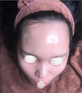 Mầm phôi thai tái sinh (mẫu mới 2024)