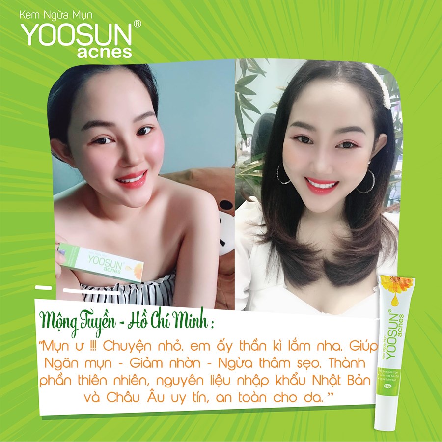 Bộ sản phẩm ngừa mụn, kiểm soát bã nhờn,ngừa thâm sẹo YOOSUN Nghệ 25gr/tuýp, YOOSUN Acnes 15gr/tuýp