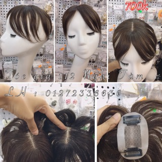 Đỉnh đầu hói tóc thật