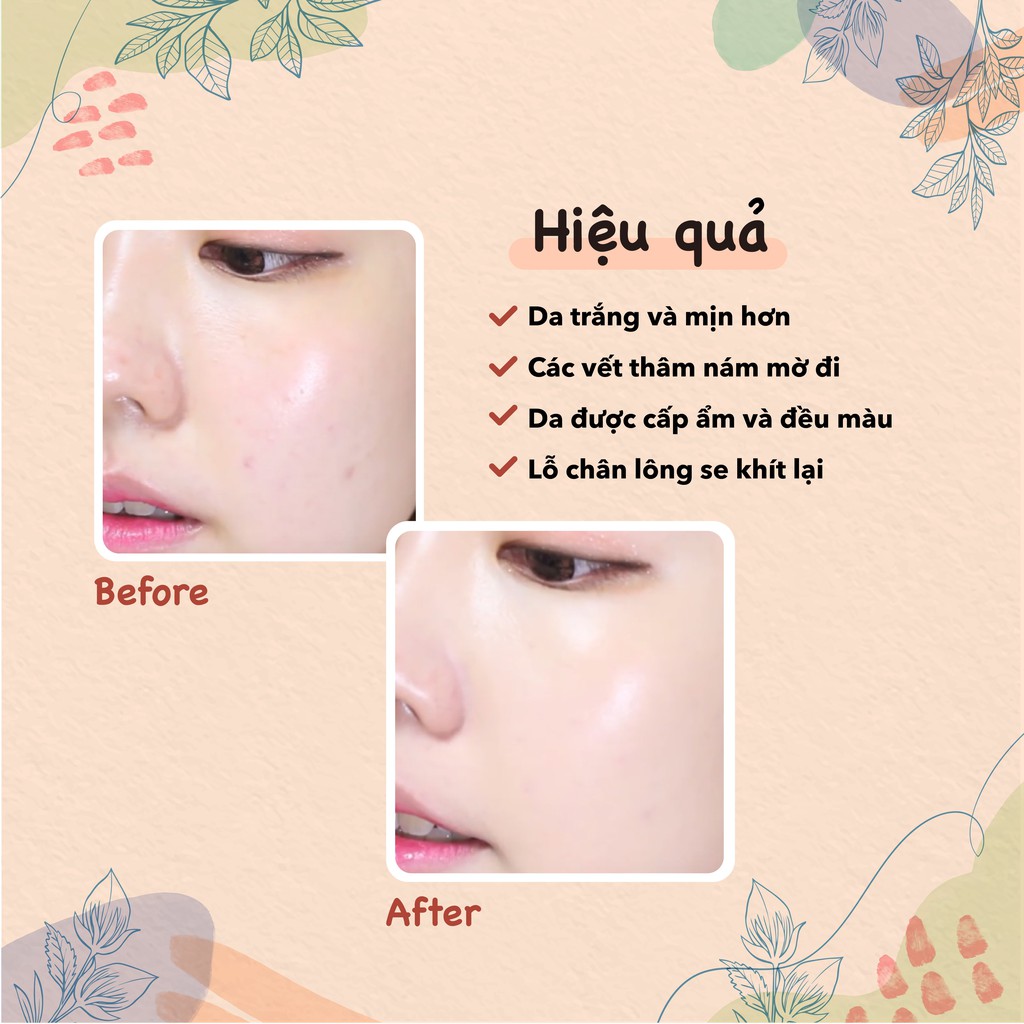 [Mã SKAMLTSW8 giảm 10% đơn 100K] Kem dưỡng trắng da ban đêm Themis Melasma Night Cream | BigBuy360 - bigbuy360.vn