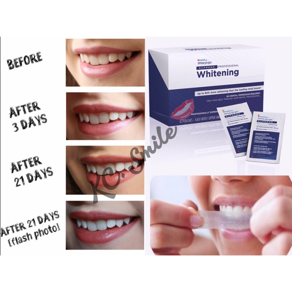 Miếng dán trắng răng Crest Supreme Professional -  Crest Whitestrips