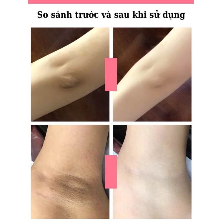 Xà phòng trái đào giảm mụn, thâm mông, nách, khuỷu tay,... - H39 | BigBuy360 - bigbuy360.vn