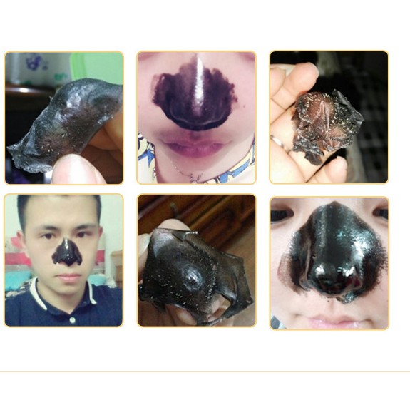 Kem Lột Mụn Cám Mụn Đầu Đen Black Mask Images | Thế Giới Skin Care
