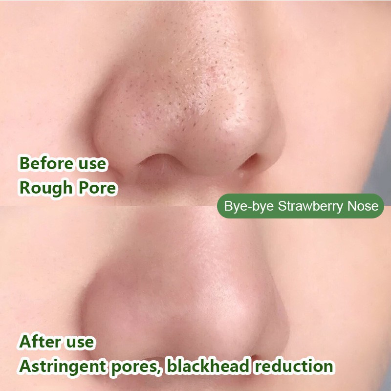 Mặt nạ ngủ Green stick chiết xuất trà xanh